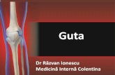 Guta - baicus.robaicus.ro/Reumatologie/Guta_2017.pdf · • A! la boala renala cronica • Colchicina si AINS – de baza pt tratamentul atacurilor • Educatia pacientului, stilul