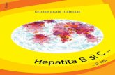 R Oricine poate fi afectat - soshepatites.org · 2 Hepatita este o inflamaţie a ficatului Ficatul este un organ vital Are rolul de a stoca, transforma, fabrica elemente indispensabile