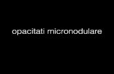 opacitati micronodulare NODULARE SI CAVITARE.pdf · • noduli conﬂuenti, bazal • "se suﬂa" rezultand pneumatocele • participare pleurala (empiem, PNO) • uneori cavitati