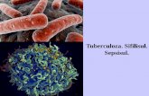 Tuberculoza. Sifilisul. Sepsisul.. Tuberculoza... · Endocardită infecţioasă verucoasă cu rupturi a sigmoidelor valvulei aortice, jos –fistulă în septul interatrial.