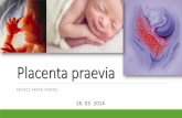 Placenta praeviadrarpad.com/pdf/9.pdf · tocolitice Hemoragii Cantitate minimă: repaus, antispastice, tocolitice Hemoragii Cantite moderată: pierdere 10-15% din volumul curculant