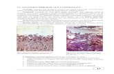 PATOLOGIA CHIRURGICALA A ESOFAGULUI · 2020. 5. 14. · nivelul trunchiului celiac și terminaţia acesteia în contact cu peretele stomacului, acolo unde ea se divide în ramurile