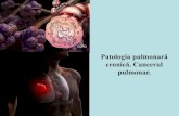 Patologia pulmonară cronică. Cancerul · 2020. 10. 24. · Carcinomul pulmonar periferic se dezvoltădin epiteliul ramificațiilordistale ale bronhiei segmentare, epiteliul bronhiolar