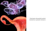 Patologia sistemului genital feminin și a glandei mamare. · Tema: Patologia sistemului genital feminin și a glandei mamare. I. Micropreparate: ... Reprezintăcea mai frecventăpatologie