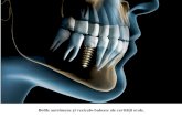 Bolile autoimune și veziculo-buloase ț · 2020. 9. 5. · Tema: Bolile autoimune și veziculo-buloase ale cavității orale. Micropreparate: № OP 27. Lichen plan oral.(Colorație