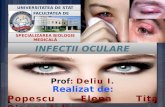 Infectii Oculare Bacteriene BUN